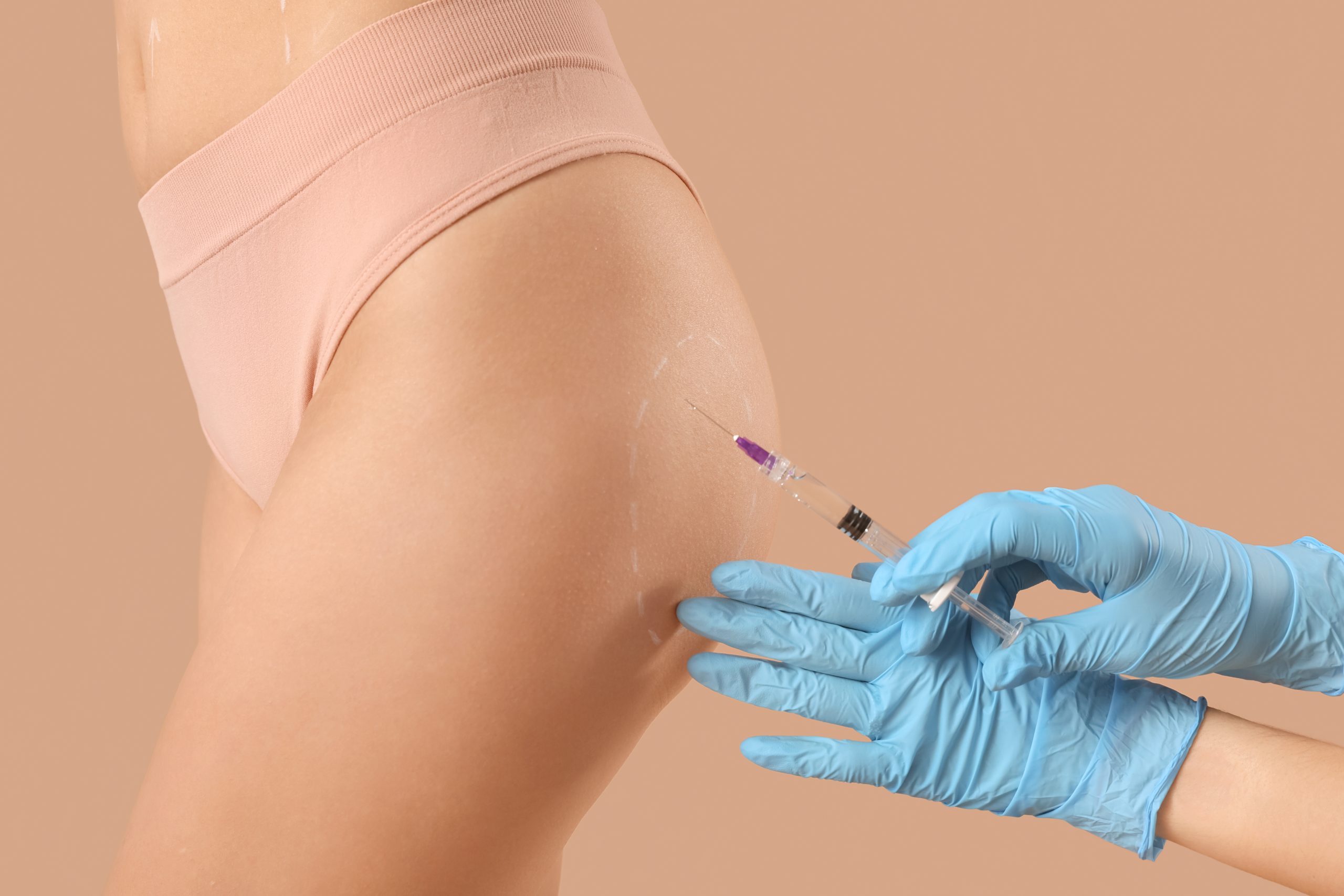 How to Remove Silicone Injections From the Buttocks? Banner
